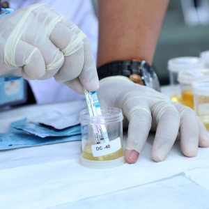 Test Urine di Terminal Tanjung Priok