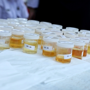 Test Urine di Terminal Tanjung Priok — foto 3
